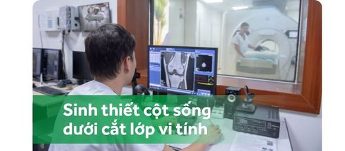 Sinh thiết cột sống dưới cắt lớp vi tính