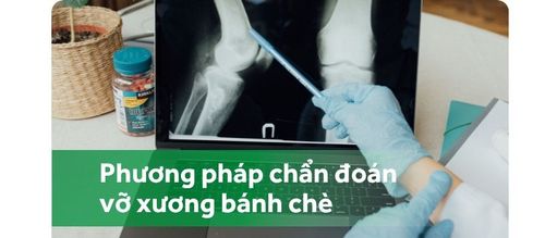 Chẩn đoán vỡ xương bánh chè bằng những phương pháp y tế nào?