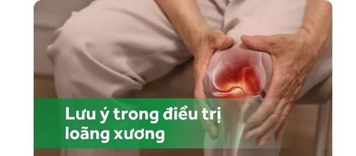 Lưu ý trong điều trị và dự phòng bệnh loãng xương