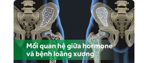 Hormone ảnh hưởng thế nào tới loãng xương?