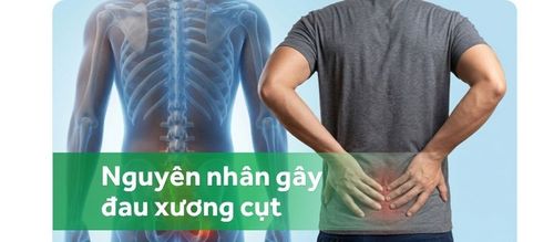 Các nguyên nhân gây đau xương cụt