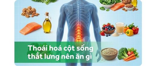 Bị thoái hoá cột sống thắt lưng nên ăn gì để cải thiện bệnh?