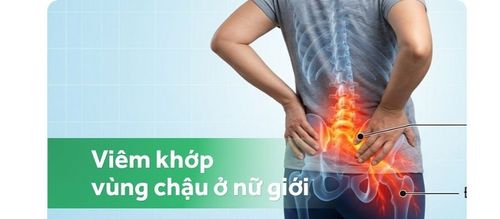 Đau do viêm khớp cùng chậu ở nữ giới