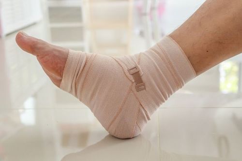 Immobilization by a cast after reduction