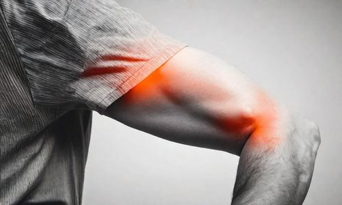Gãy xương khuỷu tay bao lâu thì lành? Giải đáp thắc mắc