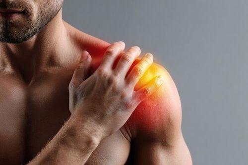 Patients often experience pain and restricted movement of the shoulder joint.