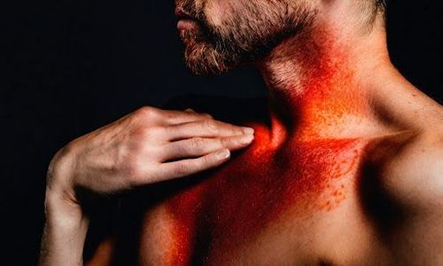 Nguy cơ lớn nhất của việc bị dị ứng thực phẩm là sốc phản vệ.