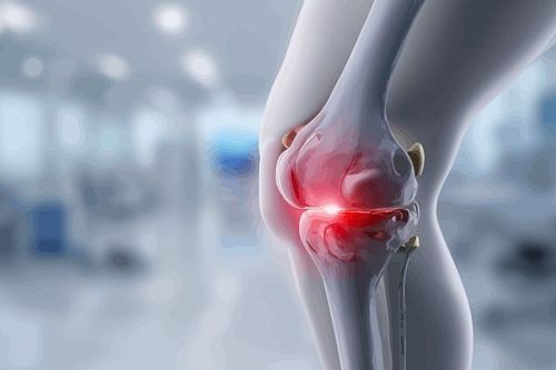 Why Does the Knee Joint Make Cracking Sounds? Is It Due to Joint Dryness?