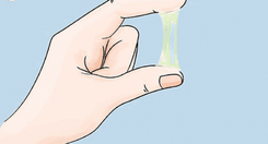 Vaginal discharge during pregnancy