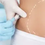 Lưu trữ Tế bào gốc Mô mỡ