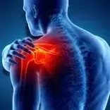 Nhóm bệnh cơ xương khớp – chấn thương: thoái hóa khớp, viêm khớp dạng thấp ...