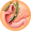 Nội soi mật tụy (ERCP)